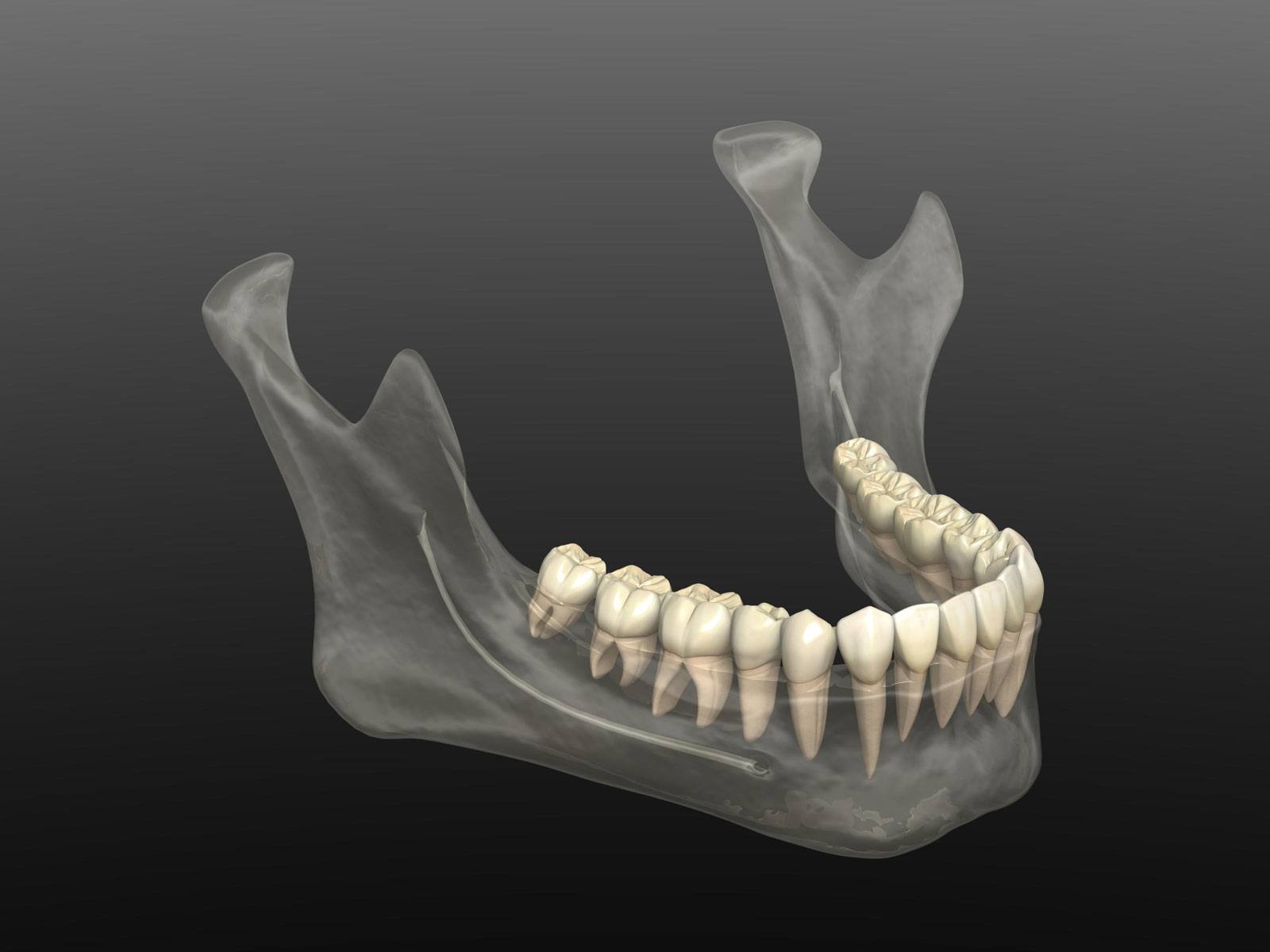 What Causes Bone Loss In A Tooth at Jean Peters blog